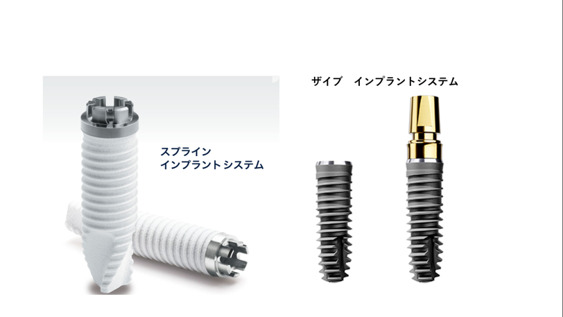 インプラント